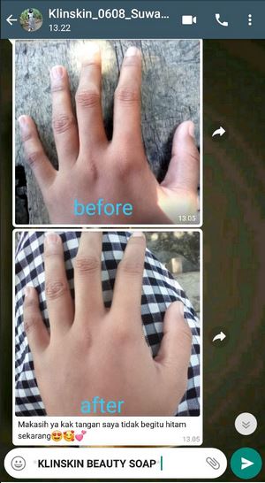Review Testimoni Sabun Klinskin Untuk Badan dan Bagian Tubuh tangan glowing cerah putih